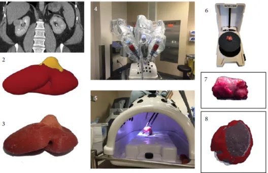Figure 3.5: Workflow for the presurgical simulation. A patient specific 3D digital model is reconstructed on the basis of the available preoperative axial imaging (CT or MRI) (1-2) and then converted into a cast silicone soft tissue model (3)