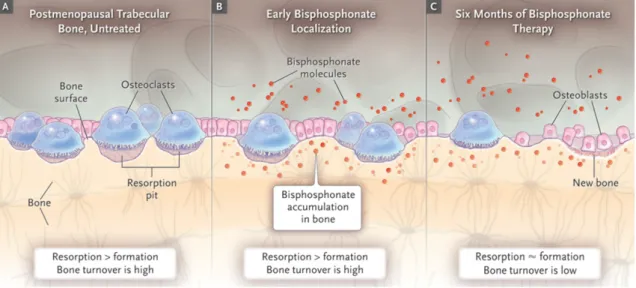 Figure 1.2: Cellular elements involved in postmenopausal trabecular bone turnover before and during bisphosphonate therapy