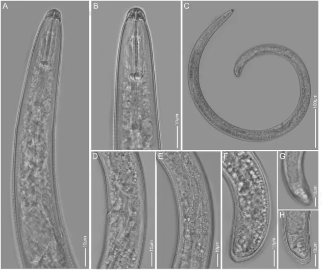 Figure 4. The LM pictures of Rotylenchus robustus A: Pharyngeal region; B: Lip region; C: Entire body; D, E: Vulva region; F, G, H: 