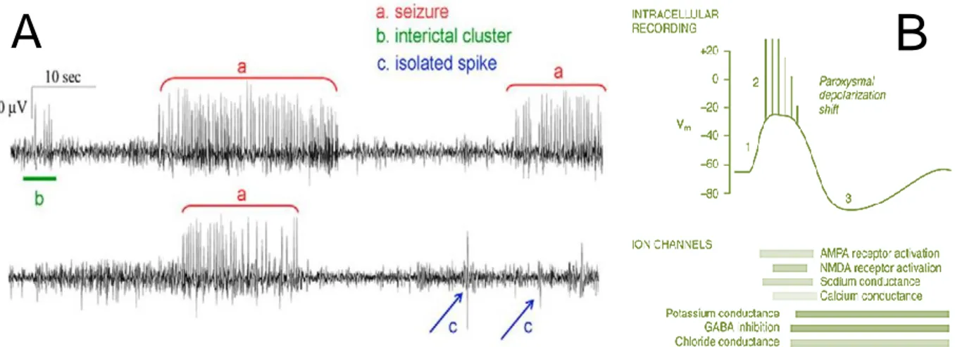 FIGURE 3. (A) Difference between interictal clusters, isolated interictal spikes and ictal  seizures in two separate EEG recordings in the IHKA model