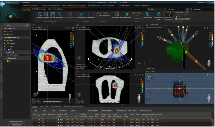 Figure 9. Overview of the plan design in RayStation® TPS of an IMRT dose plan for the thorax phantom