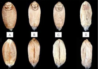 Figure 2: Symptoms of FHB in wheat  florets, healthy (left) to severe (right)  (Haesaert, 2019)