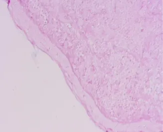 Figuur 11: AB/PAS kleuring  toont een hyperplasie van het endometrium  