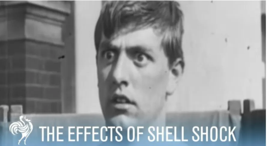 Foto 8: Shell shock (cultuurgeschiedenis, z.d.). 