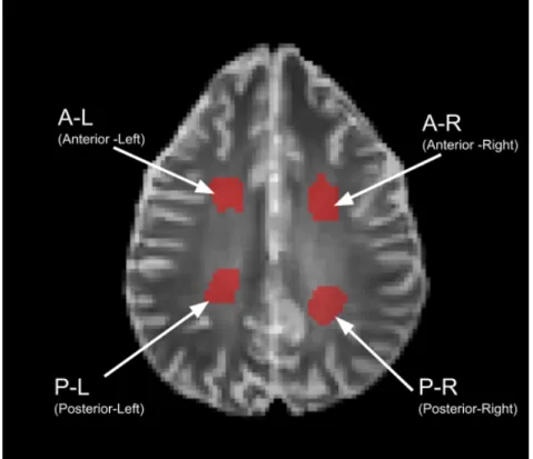 Figure 4.1: The figure shows shows an axial image slice of the brain of a volunteer where the ROIs are manually drawn in red