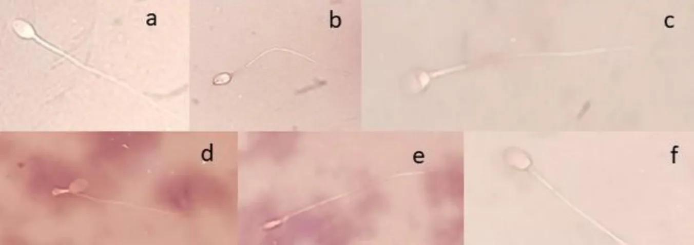 Figure 5. Examples of different morphological abnormalities. Pictures taken in Eosin-Nigrosin stain