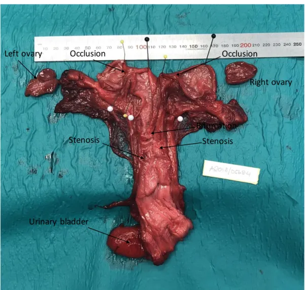 Figure 2. Occluded uterus in a female shot in 2018.