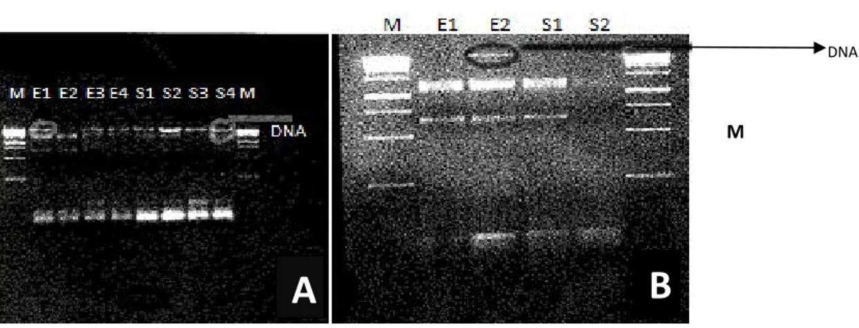 Figure 5: A) Isolation of total RNA from M. marinum before DNase treatment. Here E1, E2, E3, E4 represents 