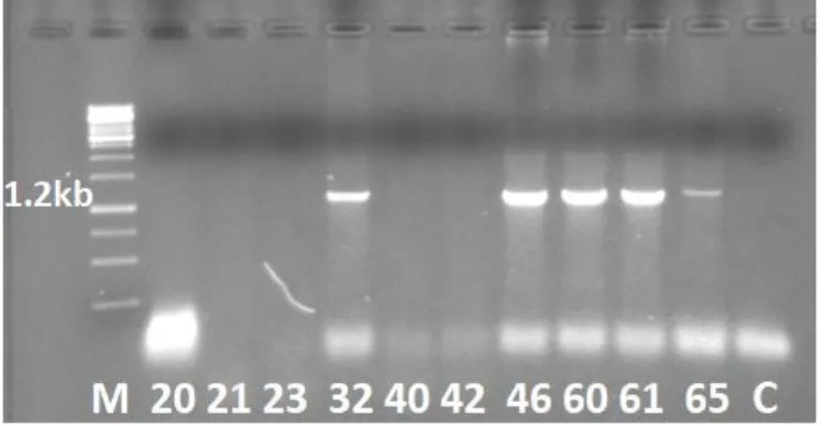 Figure  1:  Agarose  gel  electrophoresis  of  PCR  products.  Bands  with  the  size  of  1.2  kb  for  leafhopper  samples  32, 46,  60,  61  and  65  are  indicating  the  presence  of  wheat  dwarf  virus
