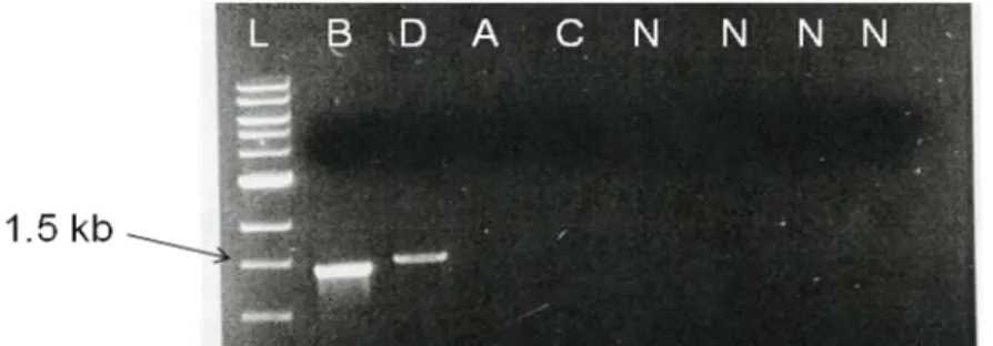 Fig  7.  Agarose  gel  electrophoresis  showing  results  of  colony  PCR  amplification  for  one  chloramphenicol  clone