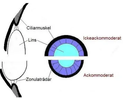 Figur 2: Ickeackommoderat- respektive ackommoderat tillstånd i ögat. Baserad på bild från Kaufman &amp; Alm,  2003.