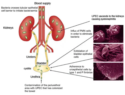 Figure 2.  Pathogenesis of UTI caused by UPEC. The faecal-perineal-urethral  hypothesis has been widely recognised to explain the ascending UTI