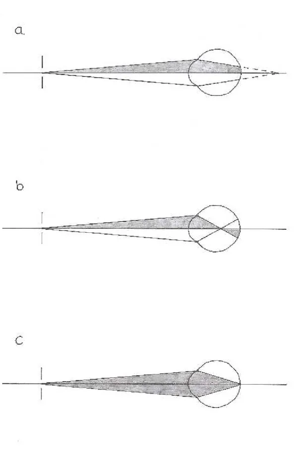 Figure 2. With, against and neutral motion. Based on the original by Grosvenor (2007 p.193) 