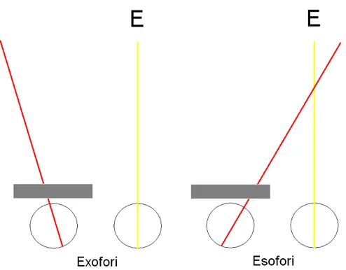 Figur  4  visar  synaxlarnas  positioner  under  ocklusion  av  ett  öga  (i  detta  fall  vänster)  vid  exofori  respektive  esofori