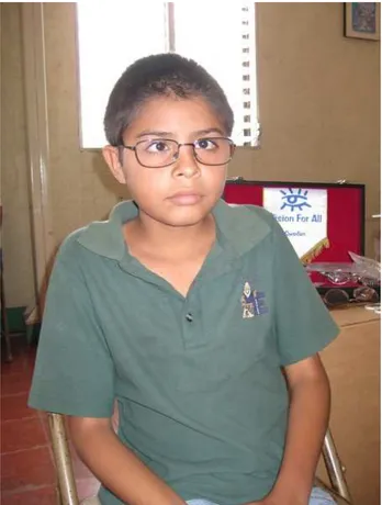Figur  5  En  pojke,  med  alternerande  esotropi,  som  erhöll ett par glasögon med pluskorrektion under en  arbetsdag i Nicaragua.