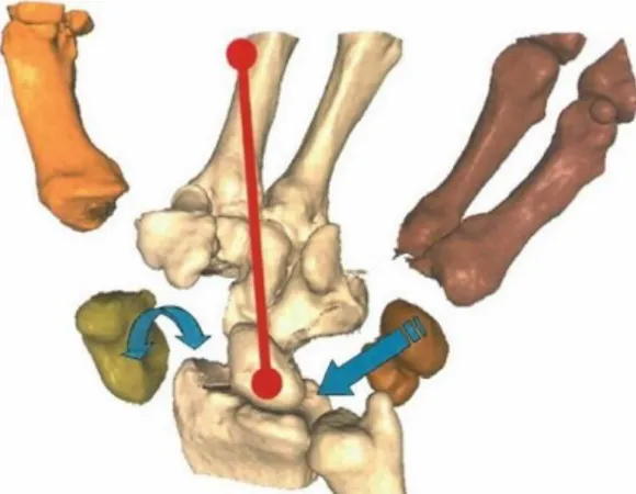 Figur 2. Handens centrala pelare (Sandow et al., 2014). Bilden är återgiven med tillstånd av SAGE  publishing