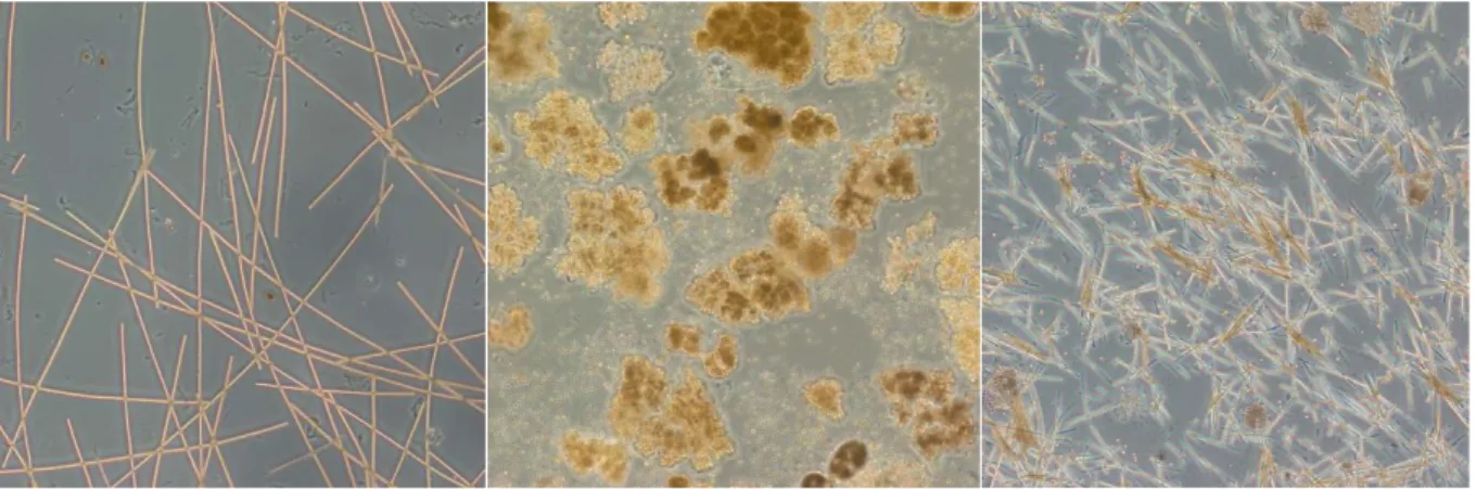 Figur 1. Exempel på cyanobakteriesläkten som kan bilda toxiner. Foto: Eva Herlitz, SLU 