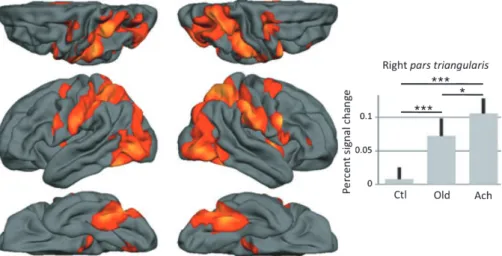 Fig. 1. Left: local brain activity in Toolmaking–Control irrespective of subject expertise (FDR P &lt; 0.05, extent k &gt; 20)