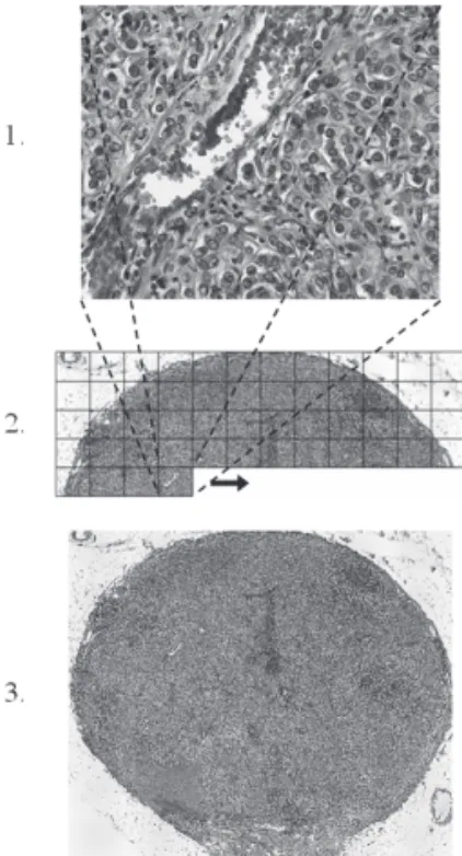 Figur 1. Ett mikroskoppreparat digitaliseras genom att ett datorstyrt mikroskop systematiskt  fotogra-ferar ett stort antal enskilda bilder (1)
