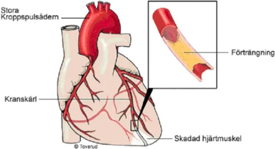 Figur 5 Definition av kammarväggarnas avgränsning i hjärtfantomet som används i 
