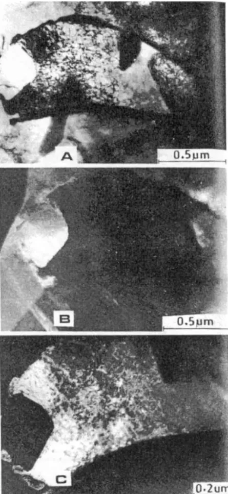 Figur 23. Tillväxt av austenit direkt ur deltaferrit (Gill et al.  1986)  A) Ljusfältbild (TEM) visande både ferrit och austenit 