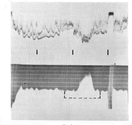 Fig. 4  B  er  et  utsnitt  a v  fotoet som viser tone nr.  43. Den begynner 