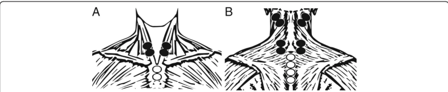 Fig. 1 Electrode placement for the anterior (a) and the posterior (b) neck. Filled and unfilled circles mark detection and reference electrodes, respectively