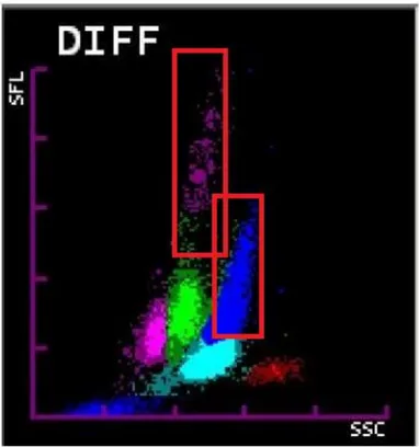 Figur 3 visar hur DIFF-scattergrammet ser ut i de fall då omogna celler  förekommer (se röd markering)