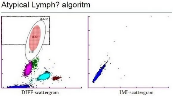 Figur 2. DIFF- och IMI-scattergram för ”Atypical Lympho?” algoritmen. Larmet  uppkommer då antalet celler i d-AI2 området i DIFF kanalen är över 
