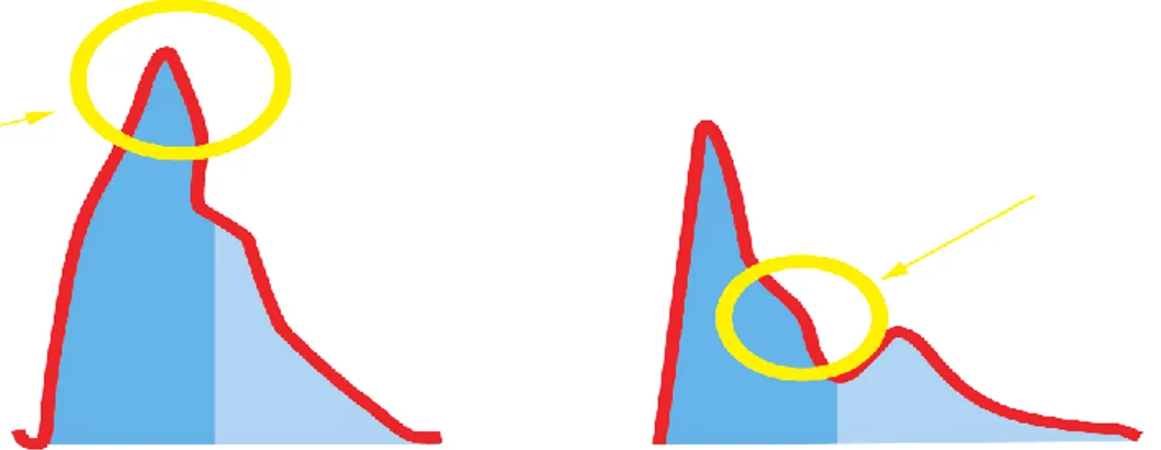 Figur 1. Vänster figur visar normal pulsvåg med tydlig reflekterande pulsvåg (rund  markering) och höger figur visar en pulsvåg som summerats med en reflekterande pulsvåg  [16]