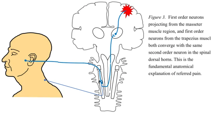 Figure 3.  First order neurons  projecting from the masseter  muscle region, and first order  neurons from the trapezius muscle,  both converge with the same  second order neuron in the spinal  dorsal horns