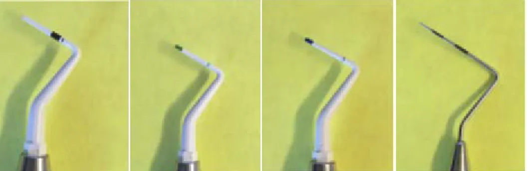 Figure 1. Left to right: white tip CBP, green tip CBP, blue tip CBP, standard  periodontal probe 