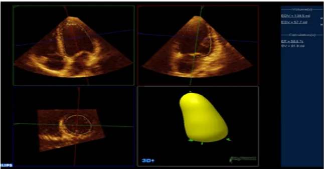 Figur 3. 3D mätning av EF med hjälp av Q-lab 3DQ Advanced. I fyr- och 