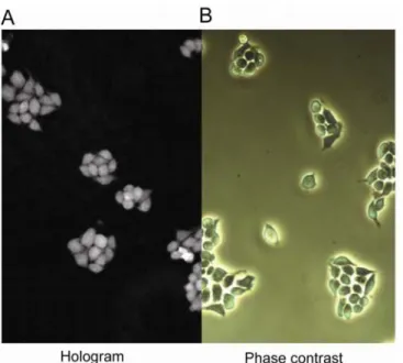 Fig. 1. A cell culture captured using digital holographic microscopy (A) and phase contrast  microscopy (B)