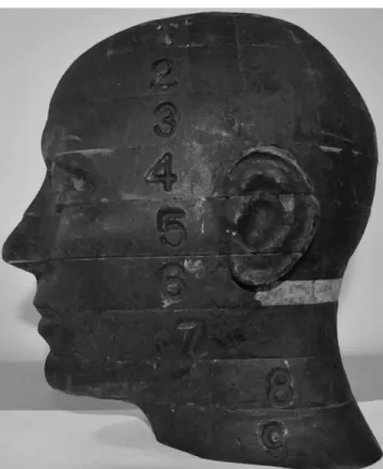 Figure 1 RANDO ® phantom head (The Phantom Laboratory, Salem, NY)