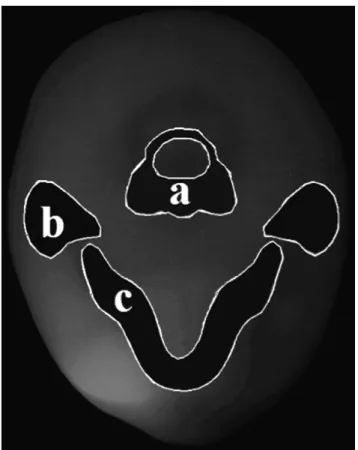 Table 3 gives the absorbed organ doses and effective doses for medium FOV (TMJ) protocols