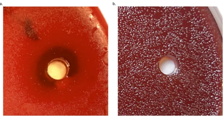 Figure 1. Growth of P. gingivalis grown on Brucella agar plate showing inhibition zone associated with 0.1 mM Sr(OH) 2 (a)