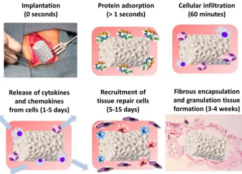 Fig. 12. Sequence of surface interactions immediately following biomaterial implantation, commencing with protein adsorption followed by cellular recruitment and the inﬂammation end stage of ﬁbrous encapsulation (From Ref