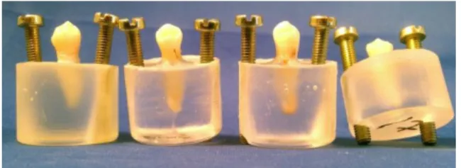 Figur 2. Inbäddade tänder med monterade skruvar