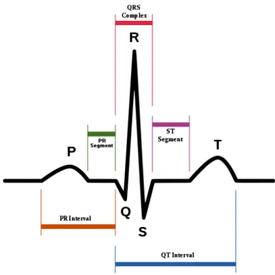 Figur 1. Ett normalt EKG-komplex med de olika komponenterna. P-vågen avspeglar förmakens  depolarisation