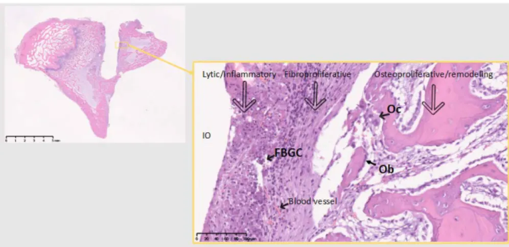 Figure 6. The 10 days Cu site. No bone on the immediate implant vicinity. FBGC, foreign body giant  cells; Oc, osteoclast actively remodeling old bone; Ob, Seam of osteoblasts producing new bone (part  of the remodeling); IO, Implant/Osteotomy