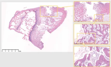 Figure 4. The 10 days Sh site. Bone remodeling with new bone formation around the osteotomy site