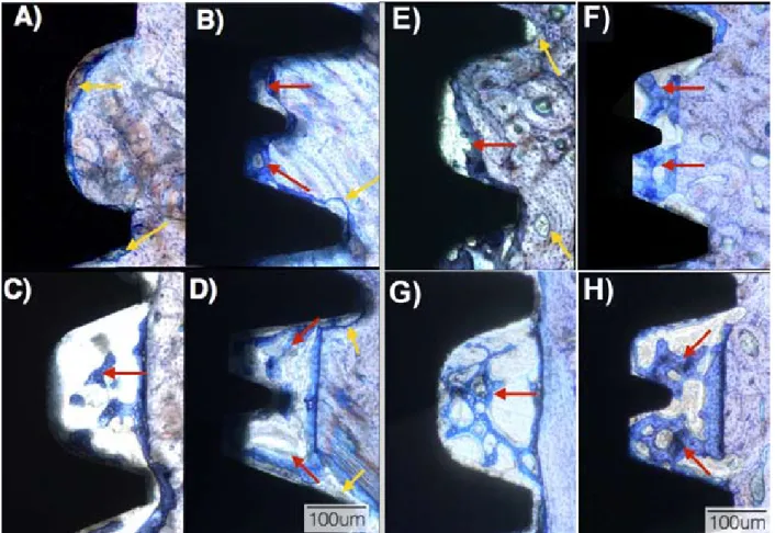 Fig. 2. Optical micrographs at 2 weeks in vivo for the (a) SW recommended instrumentation, (b) Unitite recommended instrumentation, (c) SW  overdrilling instrumentation, and (d) Unitite overdrilling  instrumentation