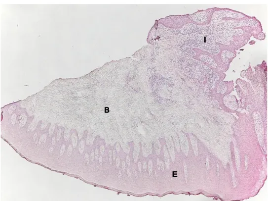 Figur 2. Cathepsin B-infärgning med immunohistokemi av human gingiva. Bild visar  bindväv (B) samt epitel (E)