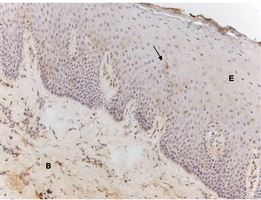 Figur 4. Cystatin C-infärgning med immunohistokemi av human gingiva. Bilden visar  epitel (E) samt bindväv (B)