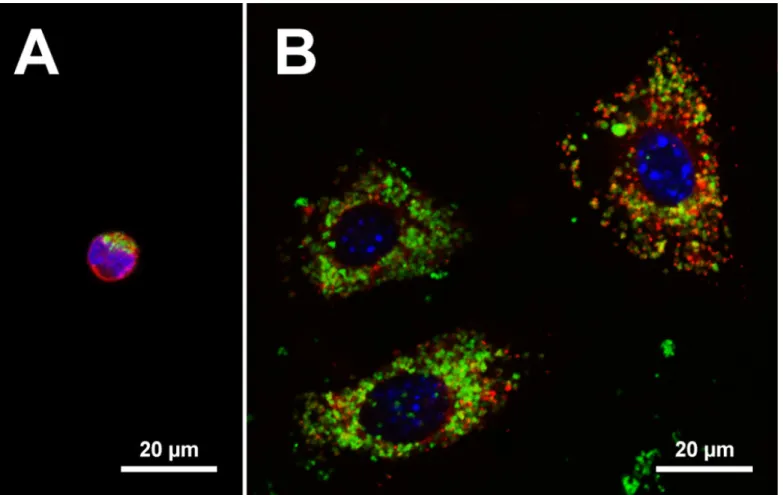 Fig. 1. Visualization of intracellular aluminium adjuvant. Confocal images of the centre sections of cells showing the nucleus as blue (DAPI) and aluminium adjuvant as green (lumogallion)