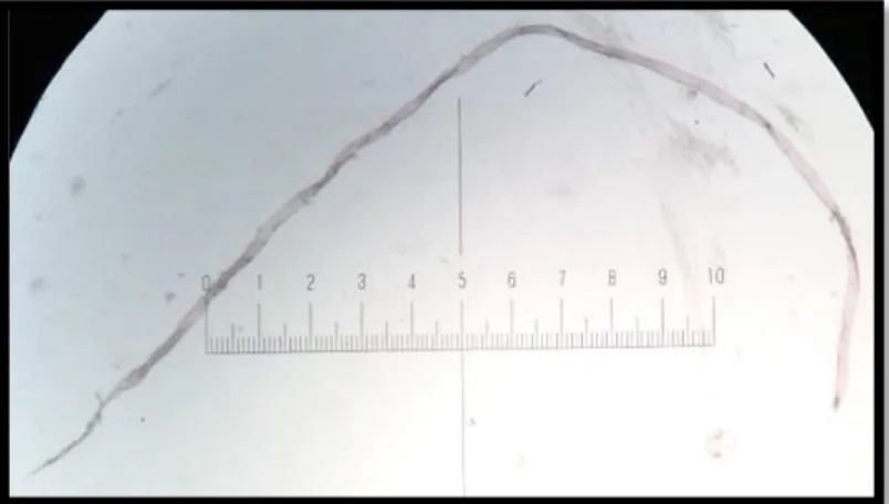 Figur 2. Röd fiber, Lomma, förstoring x10. 
