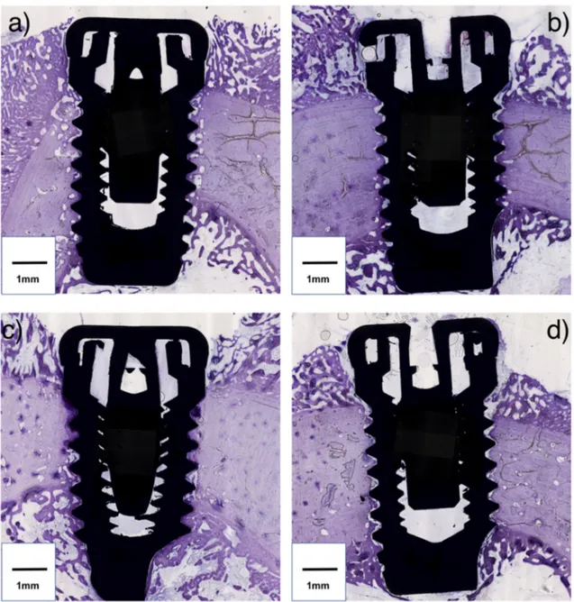 Figure 3. Histologic sections of the implant and peri-implant bone (original magnification 20×)