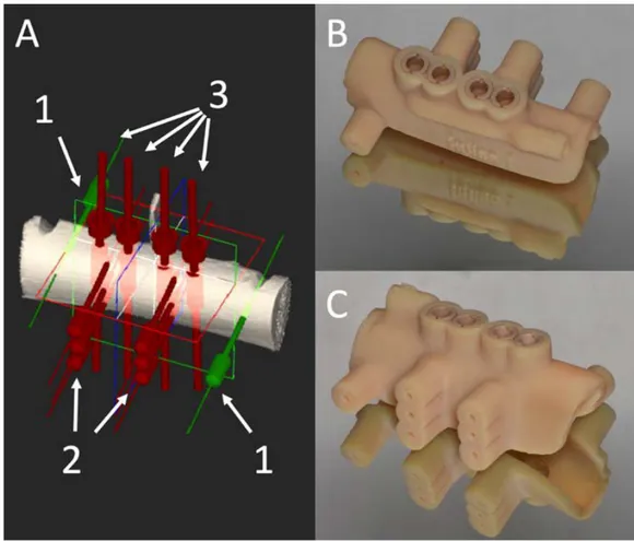 Figure 1. Virtual planning (a) and images of both sides ((b) and (c)) of one of the 3D-printed  guides utilized in the experiment