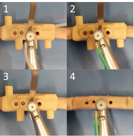 Figure 3. Comparison of the 4 experimental conditions: (1) guided osteotomy using the surgical  guide with external irrigation and an additional internal irrigation with the use of additional  built-in tubes (Group 1); (2) guided osteotomy usbuilt-ing the 